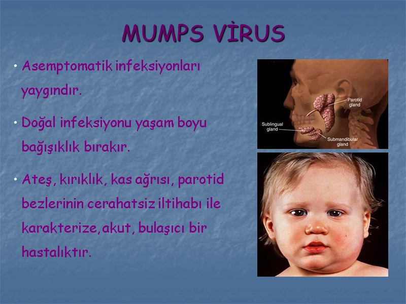 MUMPS VİRUS Asemptomatik infeksiyonları yaygındır. Doğal infeksiyonu yaşam boyu bağışıklık bırakır. Ateş, kırıklık, kas